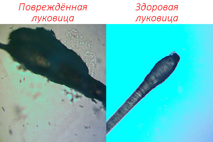 Микроскопия луковицы до и после