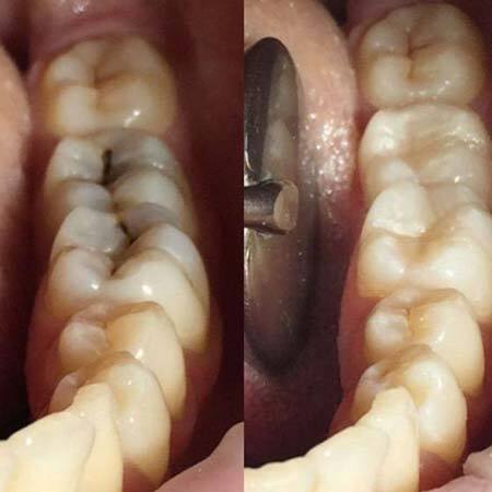 Работы стоматолога DrNigmatullina
