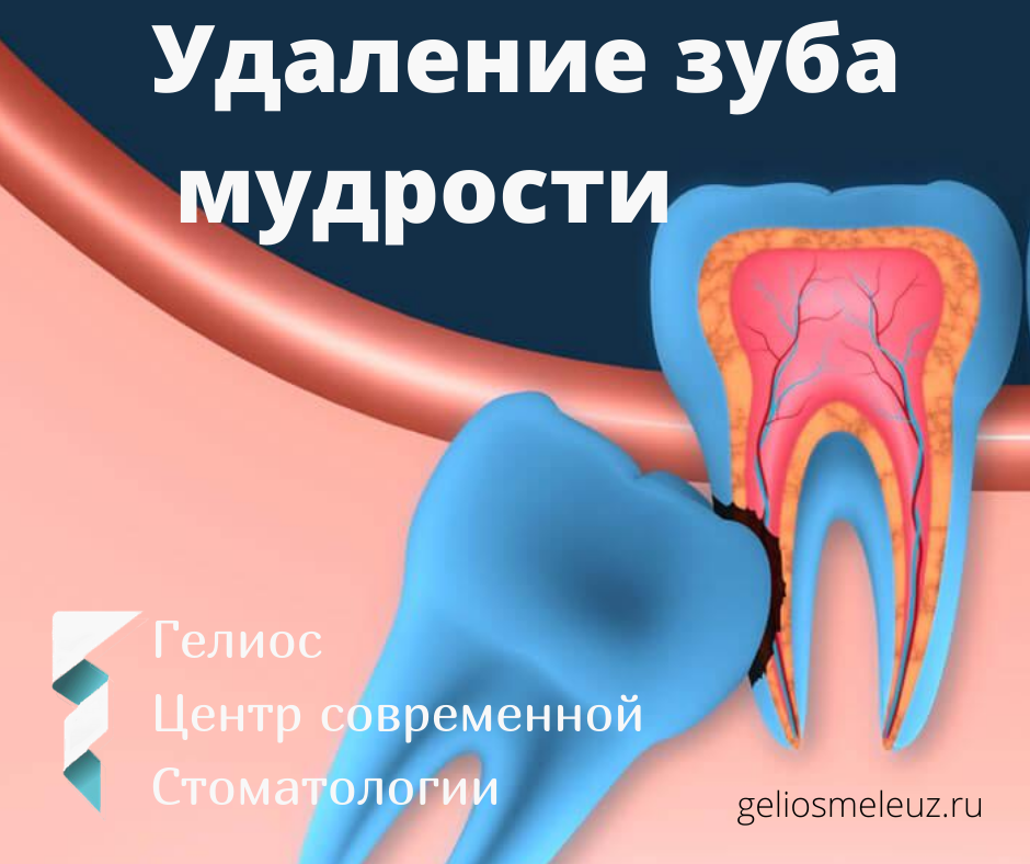 Стоматология Гелиос в Мелеузе