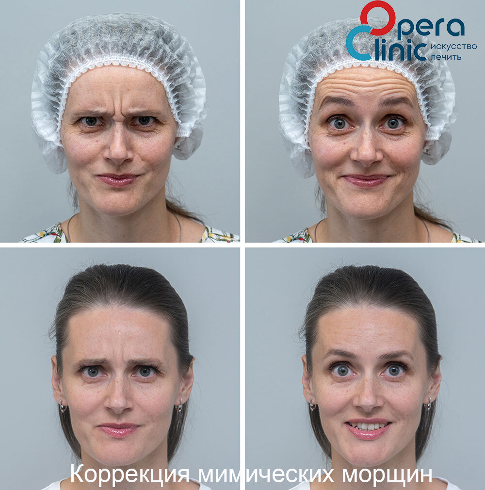 OPERA CLINIC | УСЛУГИ КОСМЕТОЛОГА В ИРКУТСКЕ